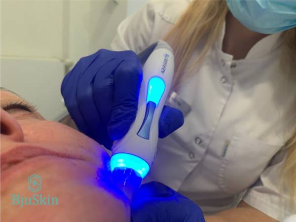 Zdjęcie: BjuSkin - depilacja laserowa